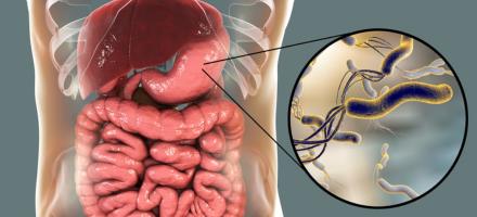 Centro Medico Carrucese novità Foto in evidenza dell'articolo urea breath test